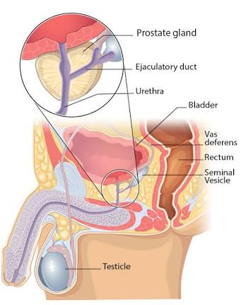 DIAGRAM A prostate.png